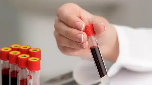 analisi del sangue milano analisi del sangue milano